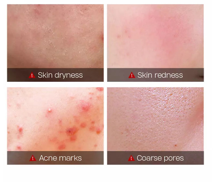 Molitude® Tea Tree Oil Cream