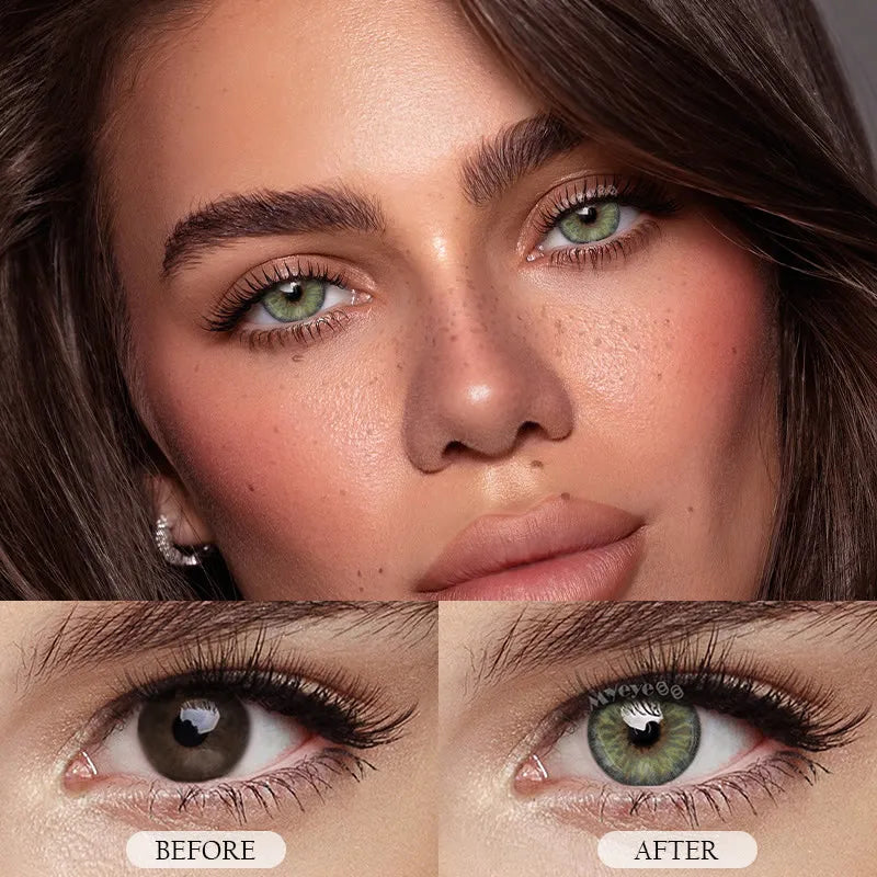 Contact Lenses