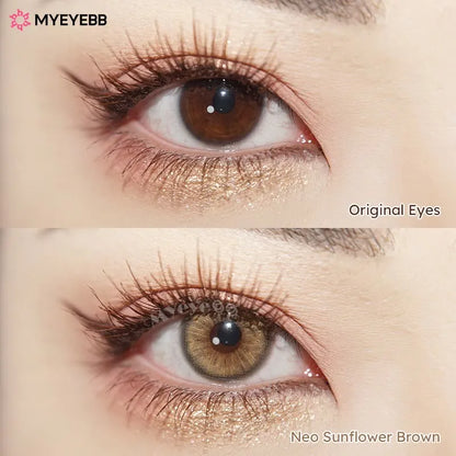 Contact Lenses