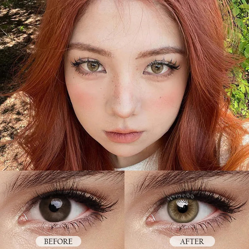Contact Lenses