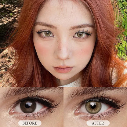 Contact Lenses