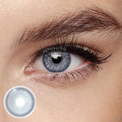 Contact Lenses
