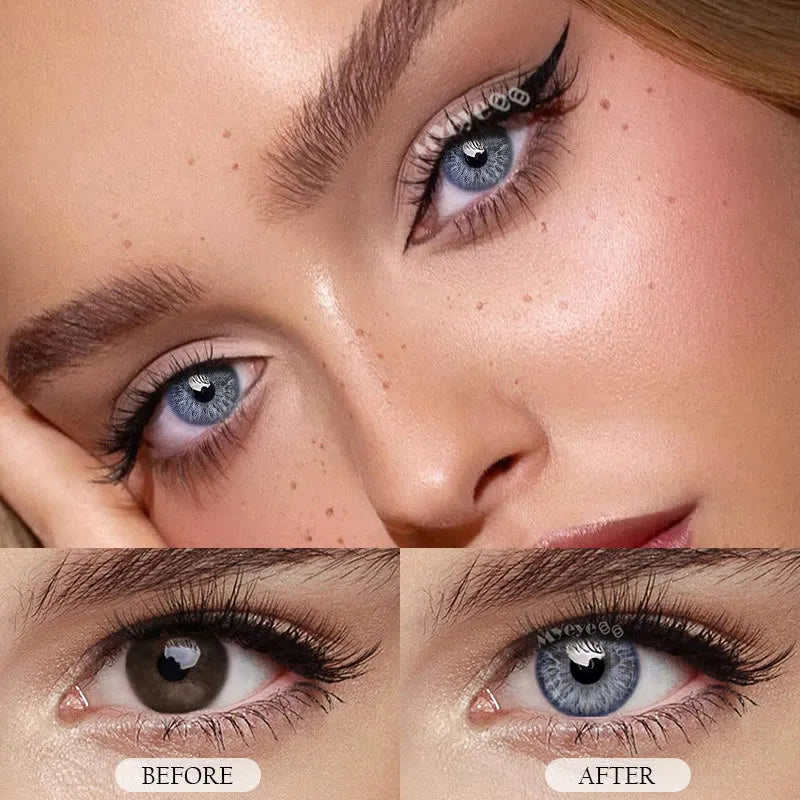Contact Lenses