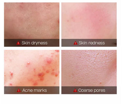 Molitude® Tea Tree Oil Cream